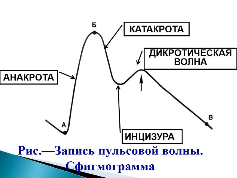 Рис.—Запись пульсовой волны. Cфигмограмма АНАКРОТА КАТАКРОТА ДИКРОТИЧЕСКАЯ ВОЛНА ИНЦИЗУРА